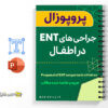 پروپوزال پزشکی جراحی های ENT در اطفال 3 پروپوزال پزشکی جراحی های ENT در اطفال